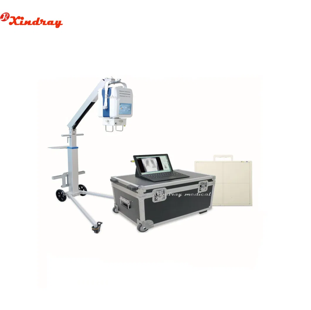 High Quality Disposable Portable Medical Elastomeric Cbi/PCA Infusion Pump